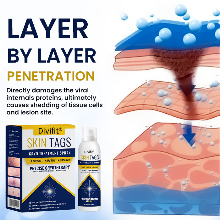 🎁 Ends Today: 70% OFF! 🏆 Virexo™ Skin Tag Cryo Treatment Spray 🧊 — Freezes Away Skin Tags & Warts in Seconds. No Blades, No Pain.